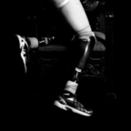 Leaked amputinbow onlyfans leaked